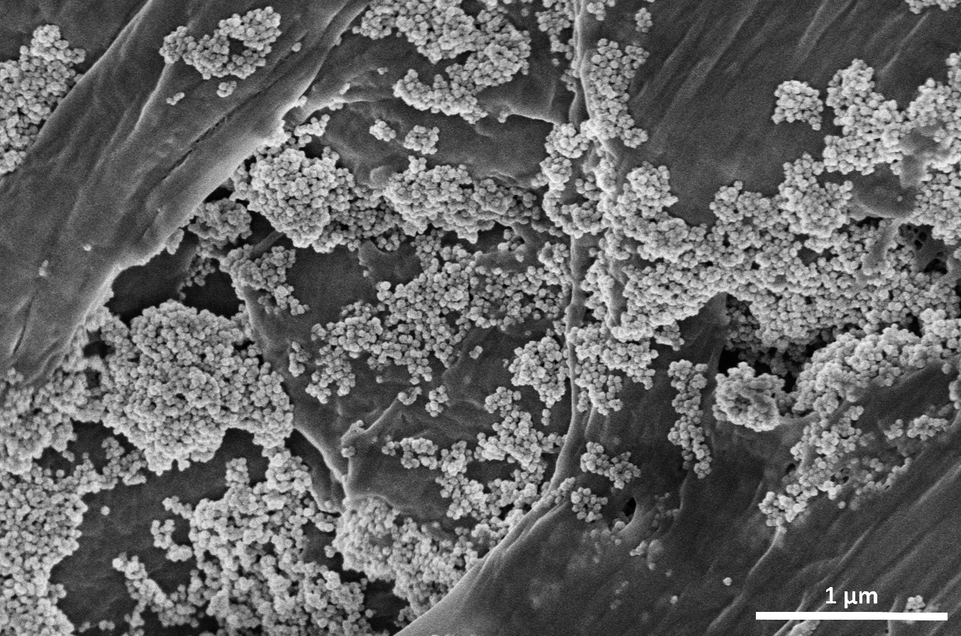 Consiguen eliminar microplásticos del agua con nanoflores de óxido de hierro